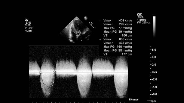 The Secret World of Blocked Fallopian Tubes